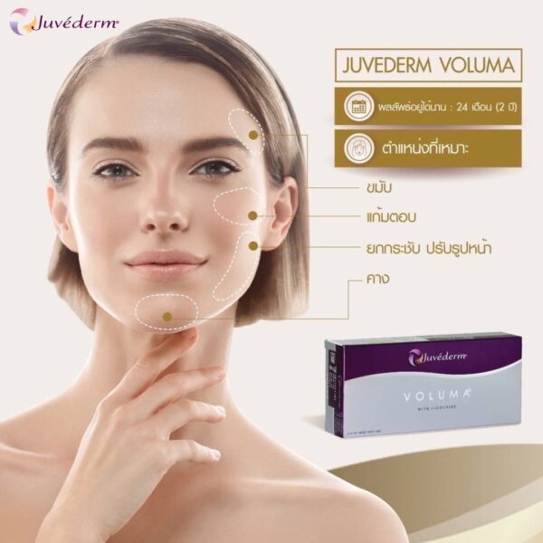 Juvederm voluma