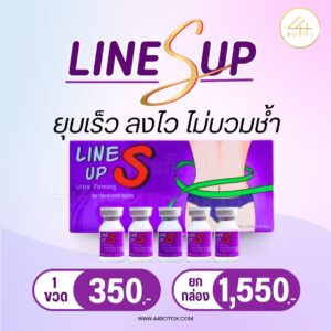 Line S up