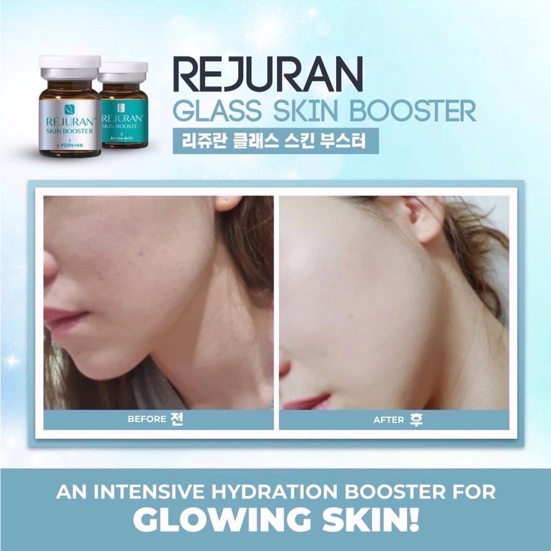 Rejuran skin booster