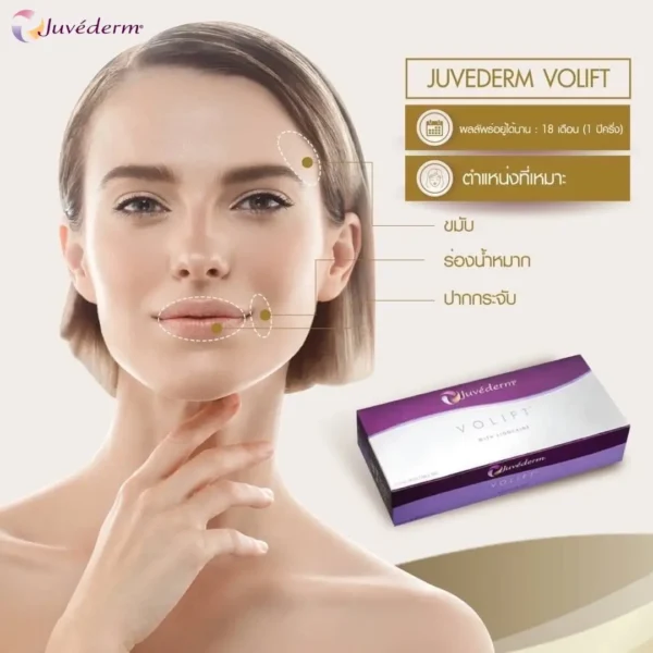 Juvederm volift