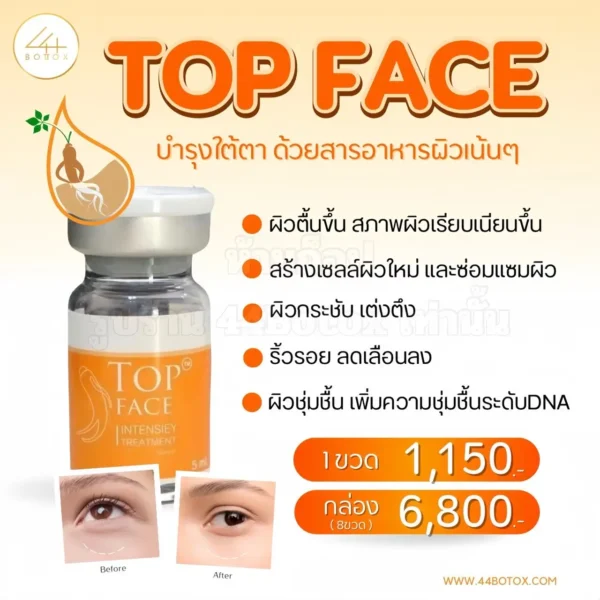 Top Face